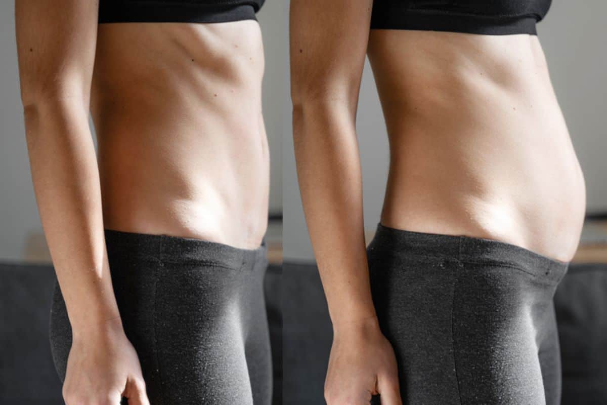 How long does diastasis recti take to improve Cranleigh?