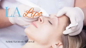 Woman receiving Actinic Keratosis Removal Treatment Cranleigh