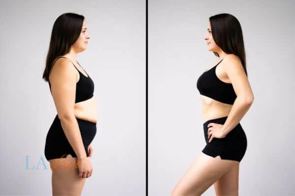 LA-EMS Body Sculpting Cranleigh results before and after of womans results on body toning.