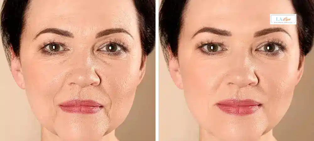 How Long Does It Take to See Results and How Long Do They Last Cranleigh?