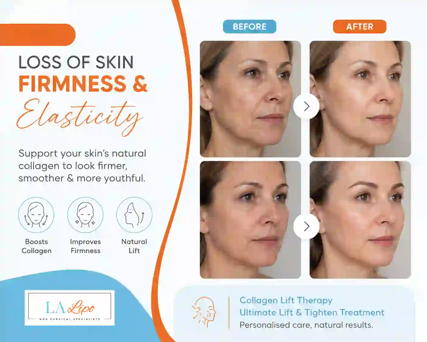 Sign #7: Loss of Skin Firmness and Elasticity Cranleigh